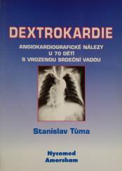 Dextrokardie-Angiokardiografické nálezy u 70 dětí s vrozenou srdeční vadou