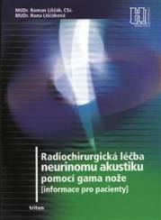 Radiochirurgická léčba neurinomu akustiku pomocí gama nože