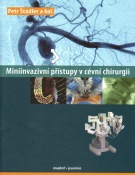 Miniinvazivní přístupy v cévní chirurgii