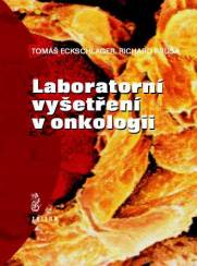 Laboratorní vyšetření v onkologii