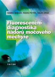 Fluorescenční diagnostika nádorů močového měchýře