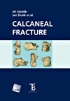 Calcaenal Fracture