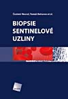 Biopsie sentinelové uzliny