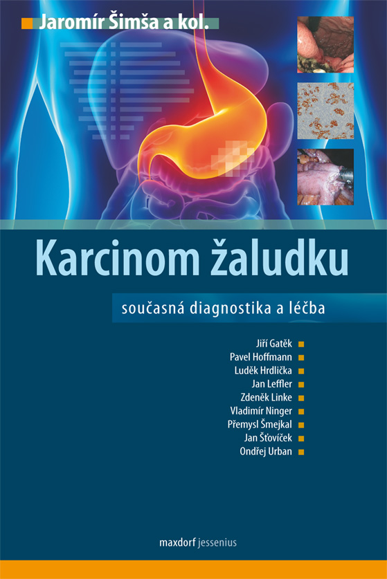 Karcinom žaludku – současná diagnostika a léčba