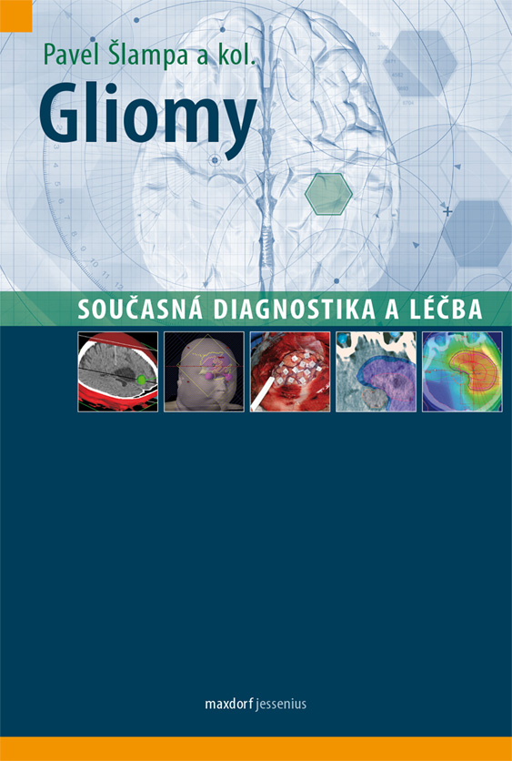 Gliomy – Současná diagnostika a léčba