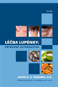 Léčba lupénky – přírodní alternativa