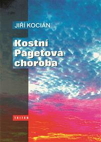 Kostní Pagetova choroba